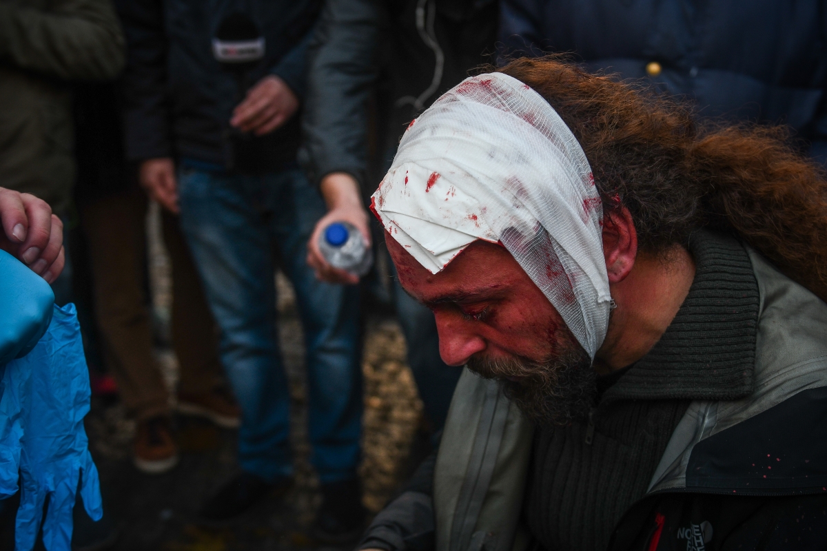 Τραυματίας φωτορεπόρτερ στο συλλαλητήριο - Ευρωκίνηση