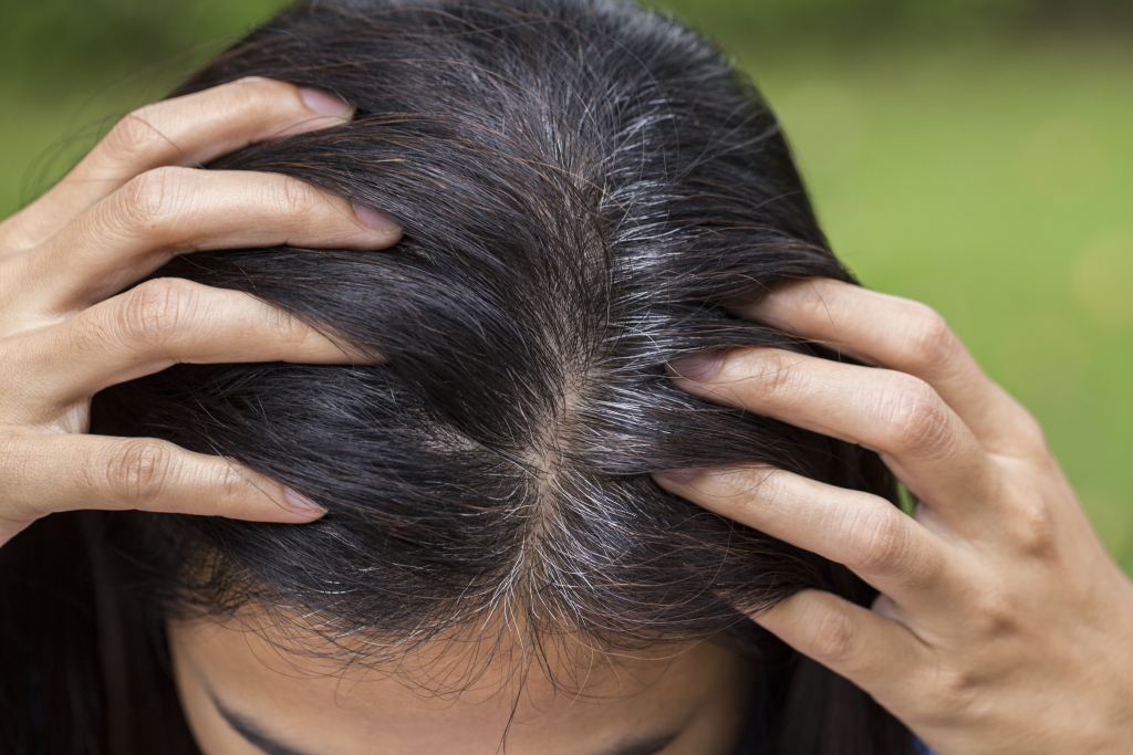 Μπορεί το στρες να γκριζάρει τα μαλλιά μας; Ναι, και οι επιστήμονες ξέρουν πια πώς και γιατί!