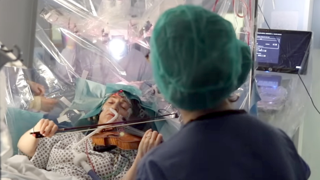 Λονδίνο: Γυναίκα έπαιζε βιολί ενώ της αφαιρούσαν όγκο από τον εγκέφαλο
