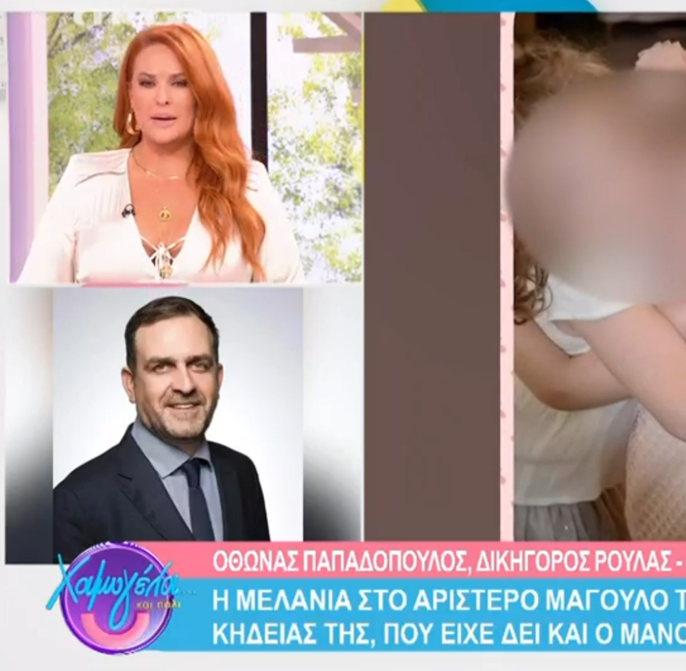 Πάτρα: Η μελανιά στο μάγουλο της Τζωρτζίνας, το μυστηριώδες φιαλίδιο και ο… Αλέξης Κουγιάς – Ο Όθωνας Παπαδόπουλος δίνει απαντήσεις