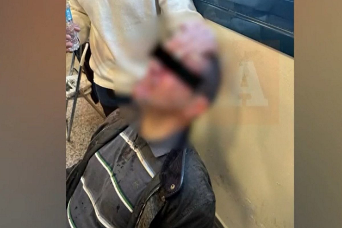 Άγρια επίθεση στη Νομική Αθηνών: Ομάδα κουκουλοφόρων τραυμάτισε φοιτητή και επιτέθηκε σε καθηγητές