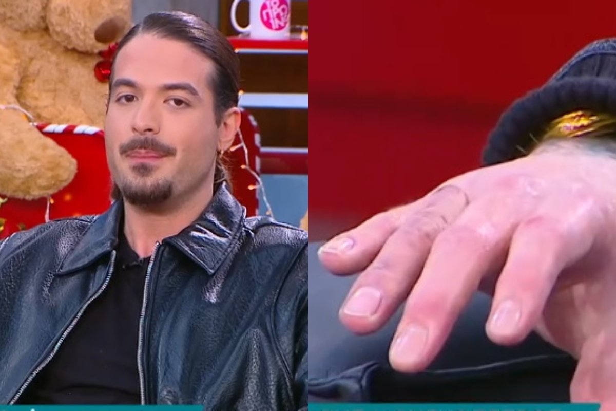 Άρης Μουγκοπέτρος: Έδειξε το τεχνητό μέλος στο χέρι του και δήλωσε αποφασισμένος – «Θα επιστρέψω στη δουλειά μου!»