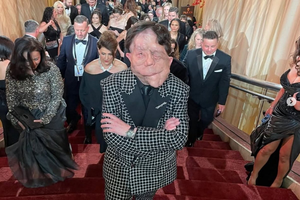 Συγκλονίζει ο Adam Pearson: Το μήνυμα αποδοχής πίσω από την εμφάνισή του στο κόκκινο χαλί