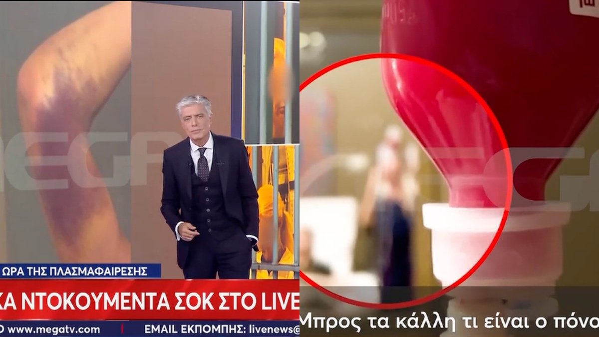 Υπόθεση Γιώργου Μαζωνάκη: Η απίστευτη «ατάκα» της γιατρού σε ασθενή την ώρα της πλασμαφαίρεσης – «Μπρος στα κάλλη τι είναι ο πόνος»